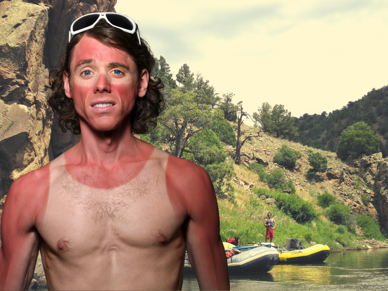 sunburn on the river